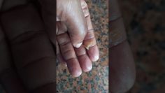 Pour Warm Salt Water Down Your Nostrils and This Will Happen